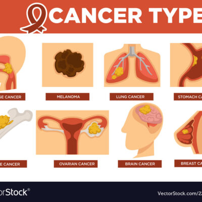 World Cancer Day 2023: कैंसर के इन 8 ‘साइलेंट’ लक्षणों को इग्नोर करने की गलती न करें!